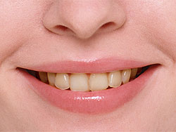 �I�t�B�X�z���C�g�j���O-�p�O