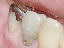 �I�t�B�X�z���C�g�j���O-�p�O