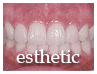 審美歯科